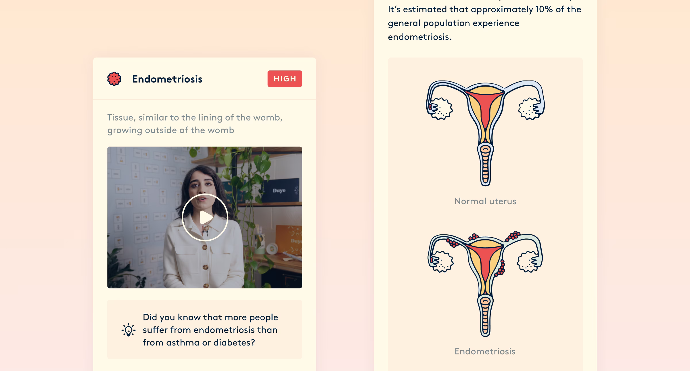 A doctor explaining endometriosis on video alongside anatomical infographics.